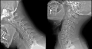 Tiens-toi droit! S'exclamait mon grand-père... et heureusement, il n'a pas connu le smartphone